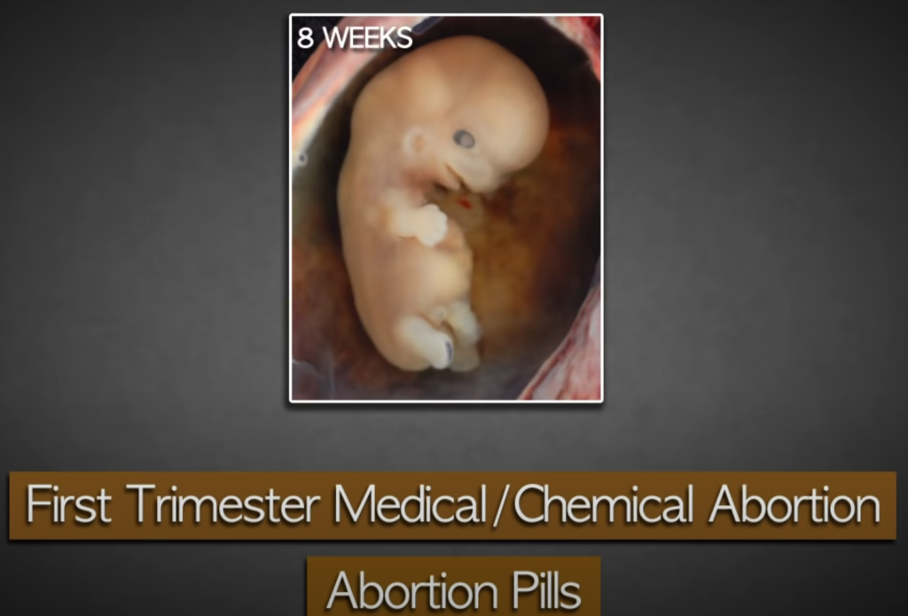 1st Trimester Medical Abortion: Abortion Pills